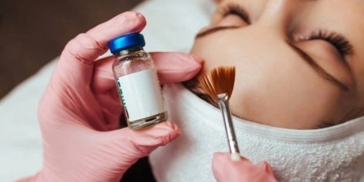 Are Chemical Peels Safe for Teenagers?
