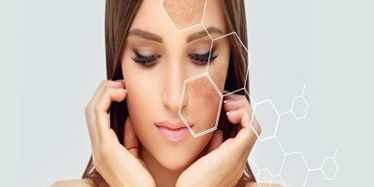 What Questions to Ask During a Melasma Treatment Consultation