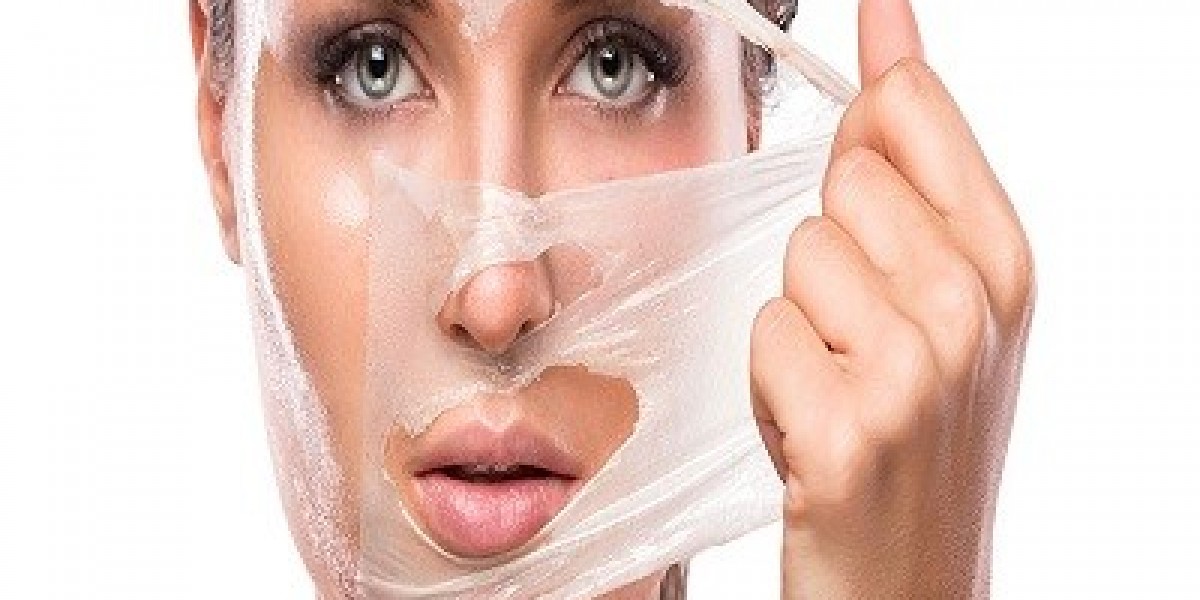 Are chemical peels effective for pigmentation or melasma?