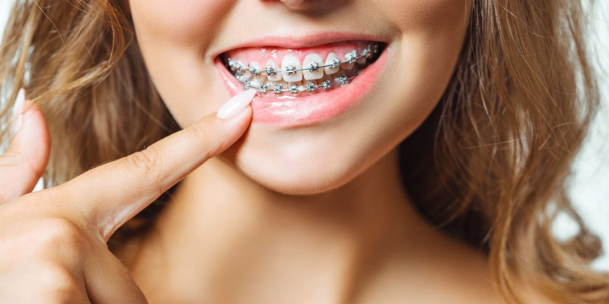 What happens after my braces are removed?