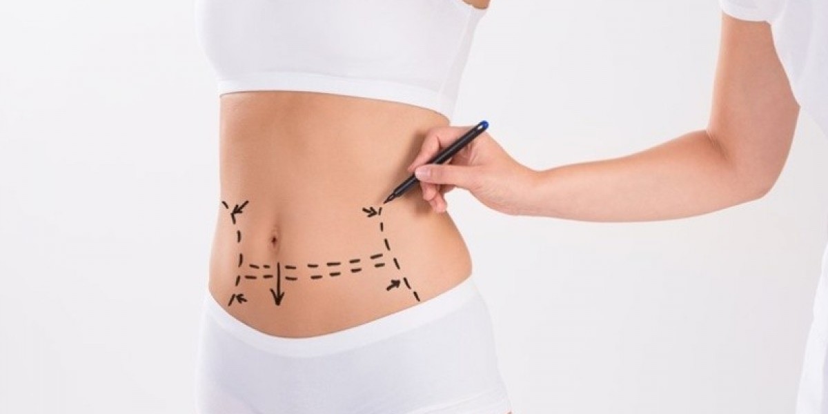 What Can Go Wrong After a Tummy Tuck in Islamabad?