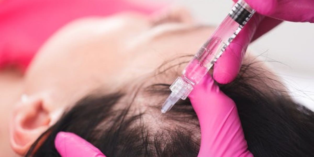 How Long Do PRP Hair Treatment Results Last in Islamabad?