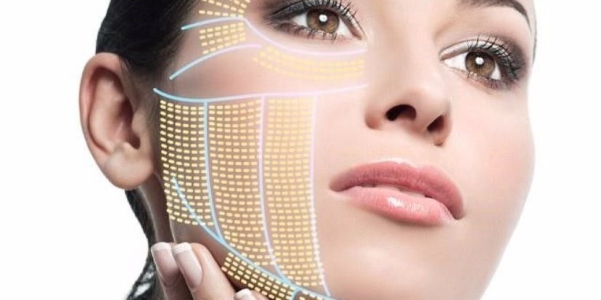 HIFU for Wrinkle Reduction: Does it Really Work?