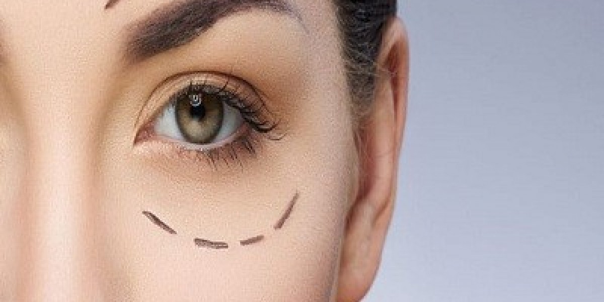 A Complete Guide to Eyelid Surgery in Islamabad