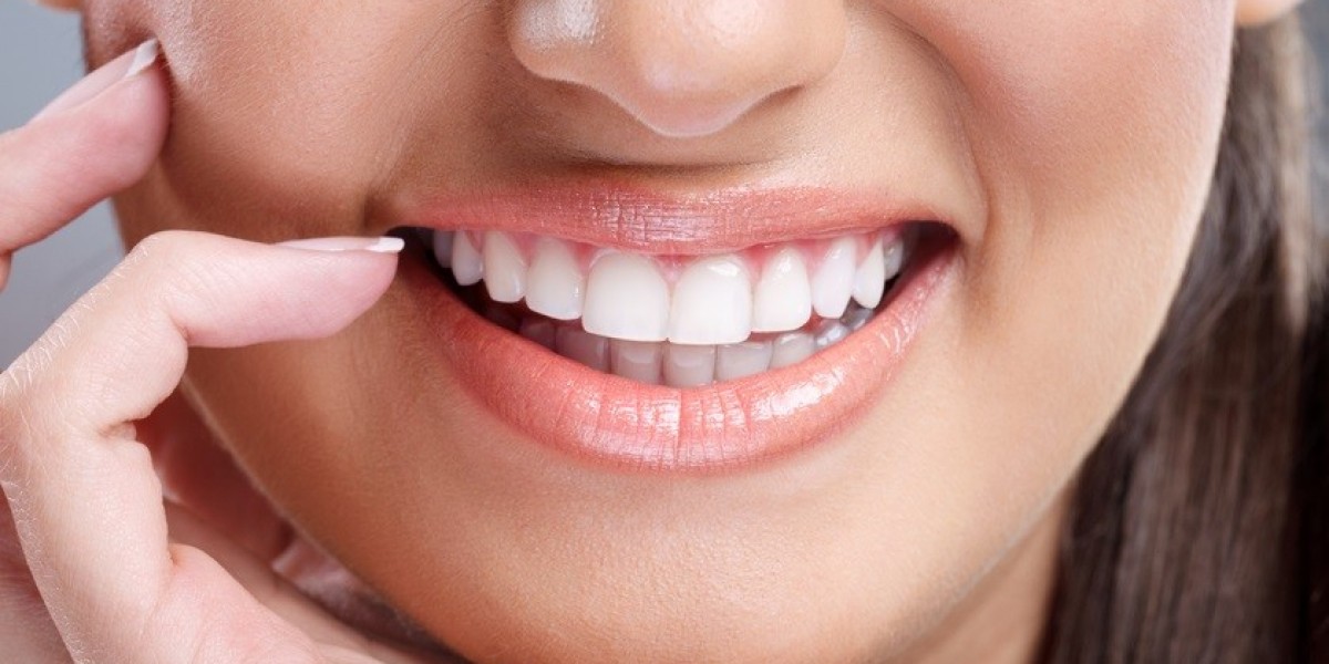 Side Effects of Teeth Whitening and How to Avoid Them