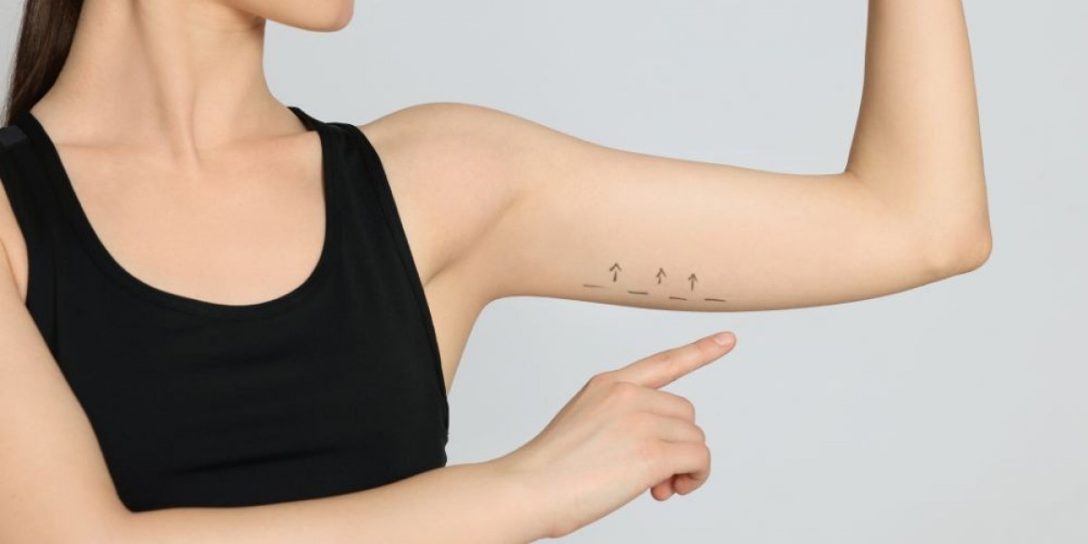 Arm Lift Surgery in Islamabad: Before and After Results