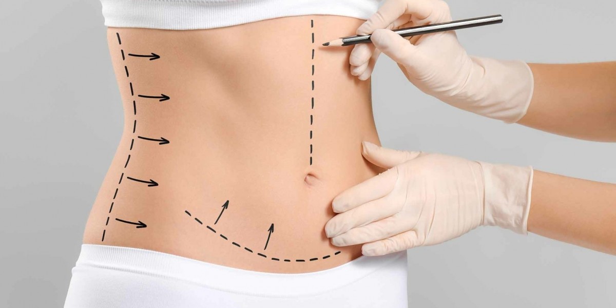 10 Common Fears Before Liposuction and How to Overcome Them