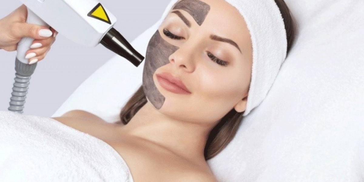 Laser Carbon Peel in Islamabad: FAQs Answered