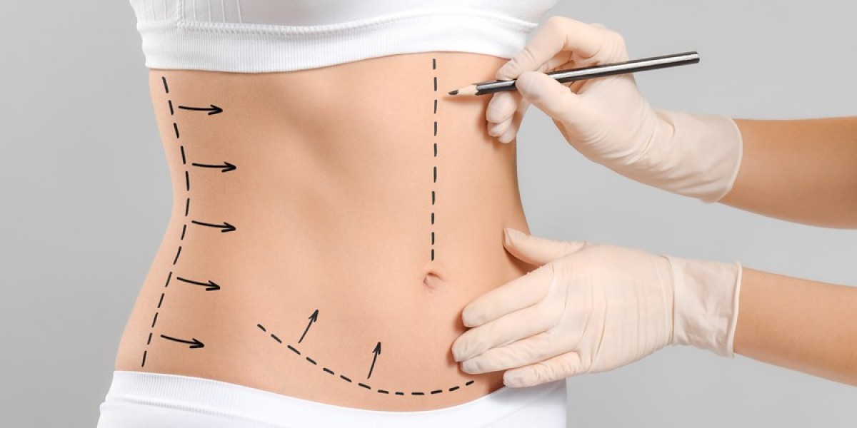 Pain management after a tummy tuck