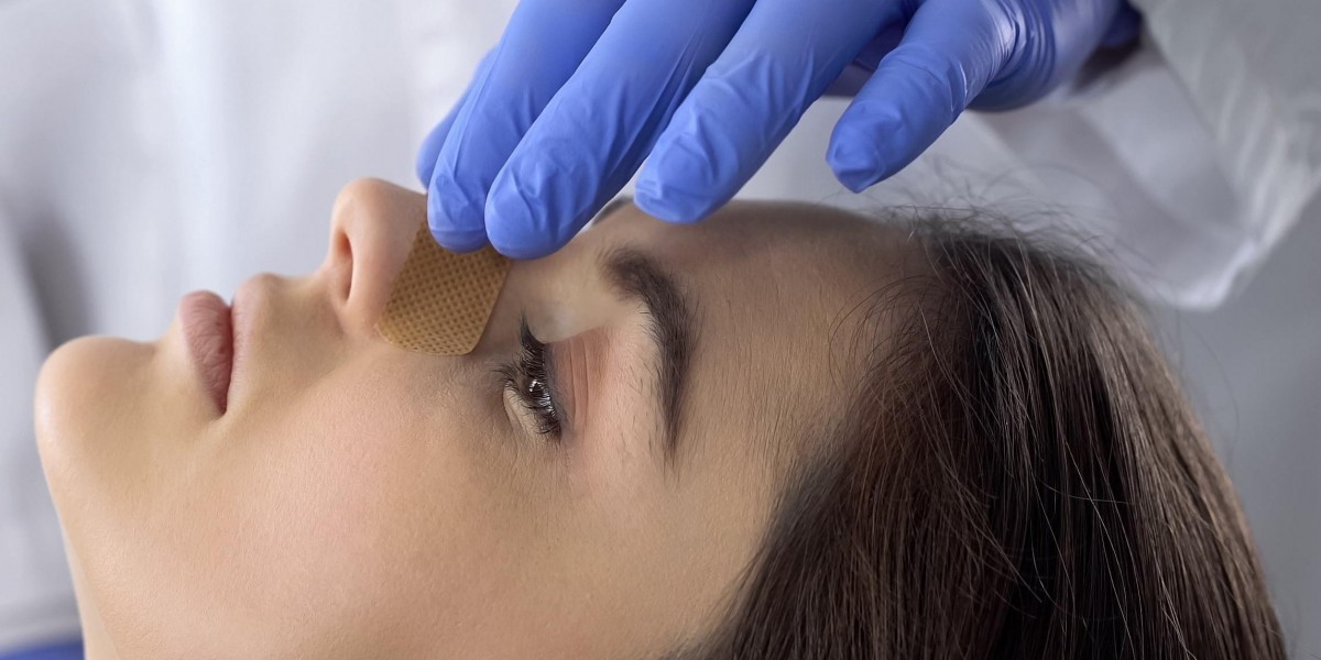 How to Prepare for Your Rhinoplasty Consultation in Islamabad