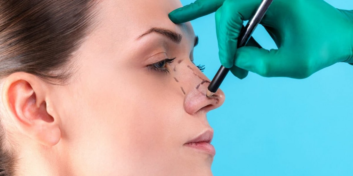 Non-Invasive Techniques to Complement Rhinoplasty in Islamabad