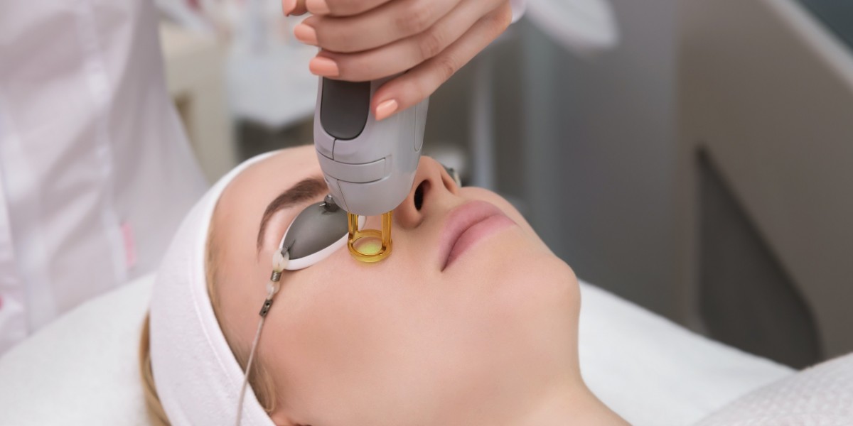 Laser treatment in Riyadh for rosacea management