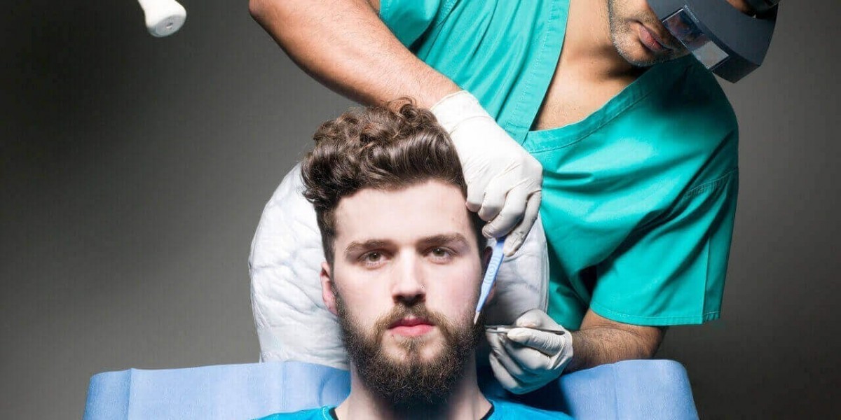 Beard hair transplant in Riyadh: patient success stories and real-life experiences